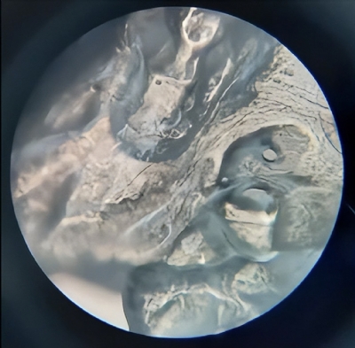 SỢI YẾN SÀO DƯỚI KÍNH HIỂN VI CÓ GÌ ?